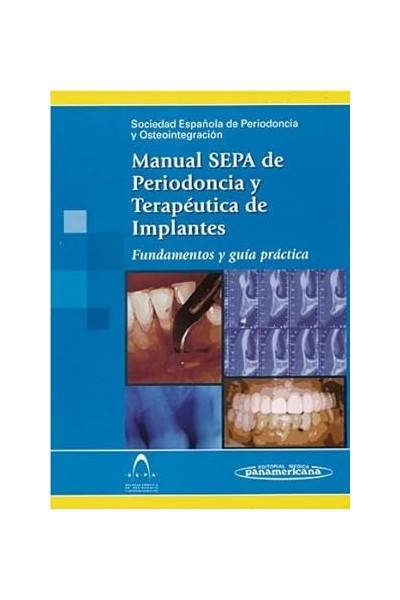 Manual SEPA de Periodoncia y Terapéutica de Implantes. Vol.(2)